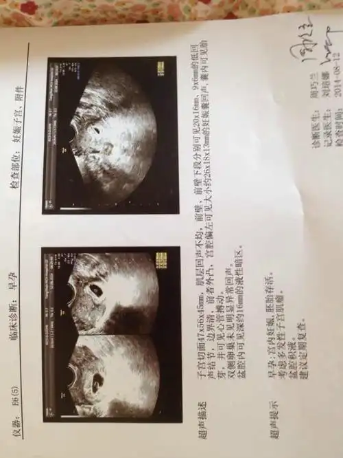 纯. 2014-07-20 赵素芬 医师 孕囊算男女准吗?孕囊大小约