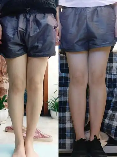 姐妹们我小腿外翻是不是越来越严重了啊01