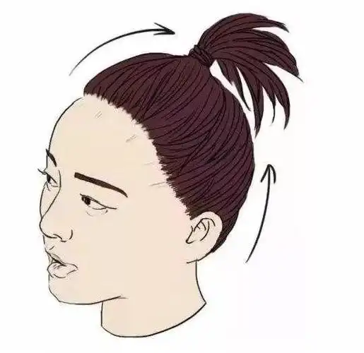 年轻女性发际线后移的原因(女性发际线后移)4