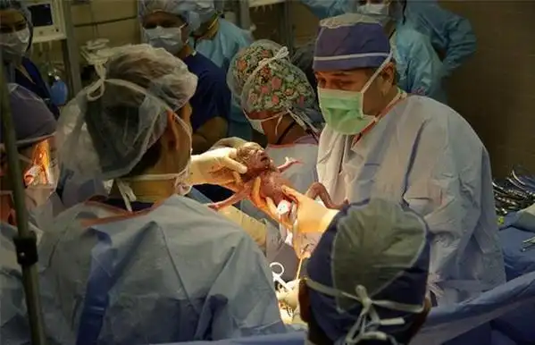 进产房不到三分钟,小孩竟啪啦啪啦生下来,看到数量,护士晕了