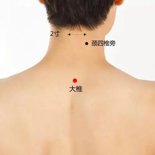 第二步 "毛巾搓颈"3分钟后,喷精油在肩颈区域,选四大穴位——大椎穴