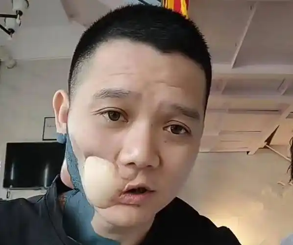 生前嚼了6年槟榔,脸上最后一次溃烂_傅松_傅蕊_父亲