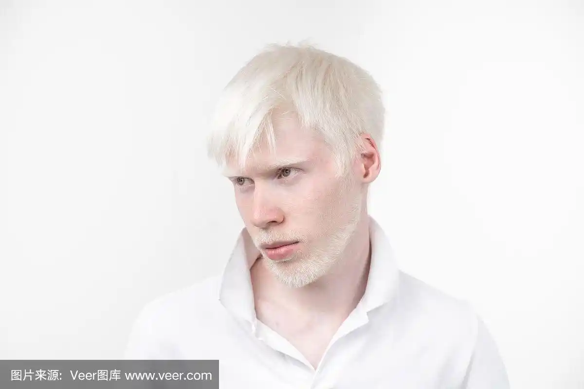 一个白化病男子的肖像在工作室穿着t恤孤立在一个白色的背景.