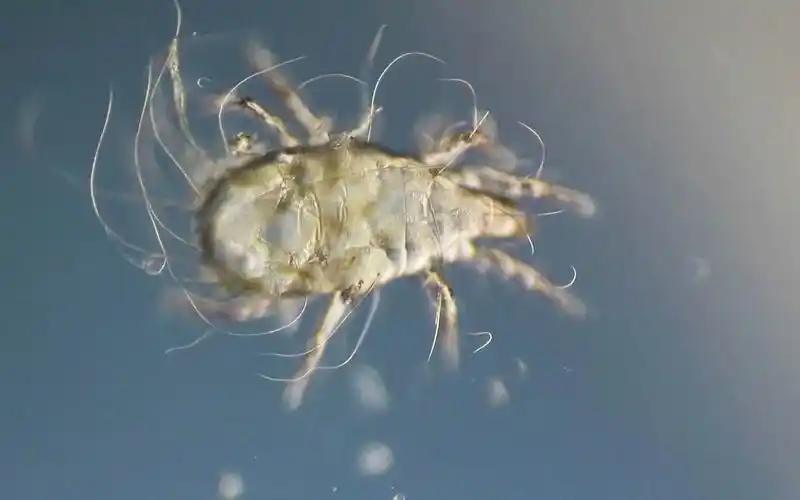 显微镜下的尘螨 dust mite under the microscope