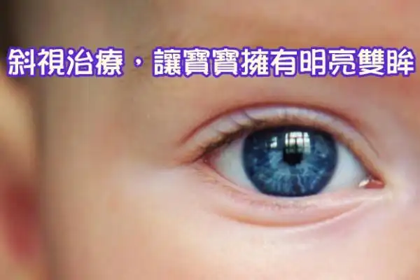 斜视治疗,让宝宝拥有明亮双眸