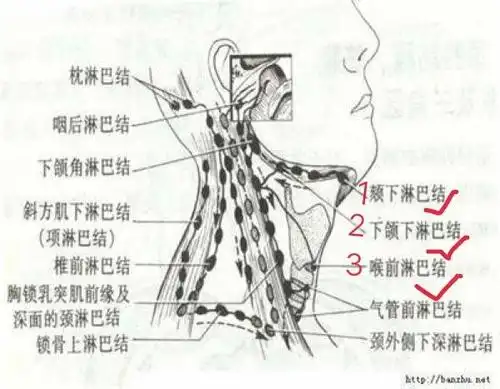脖子地方淋巴结突然肿大了