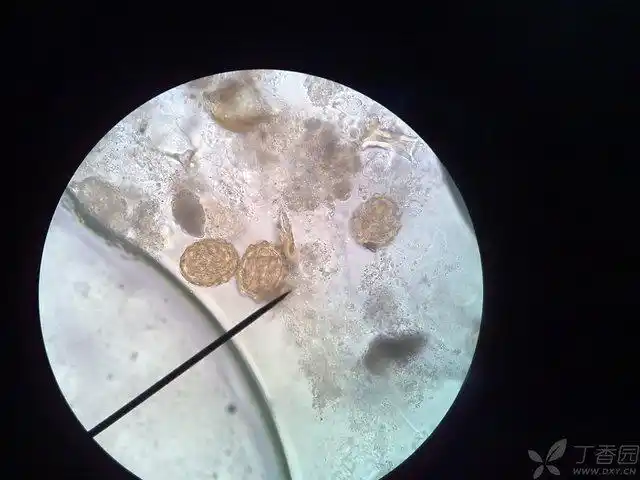 以上5幅为 受精蛔虫卵(如果有不同意见请指正哦)
