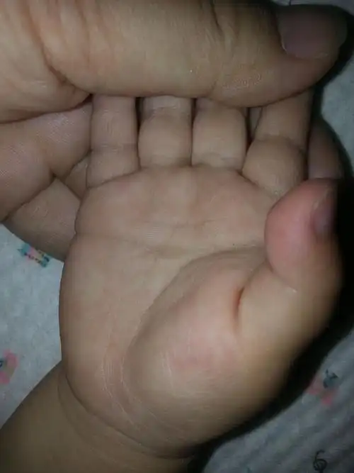 您好,大师,能不能帮我看看我宝宝的手是不是假性断掌呢?