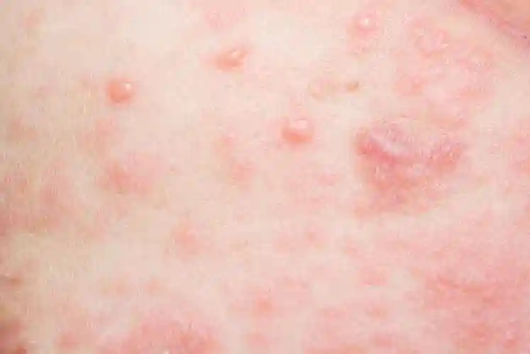 冬季皮肤干痒,可能暗示身体出现这3种问题,问题可大可小