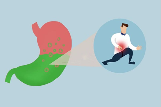 胃酸过多如何根治