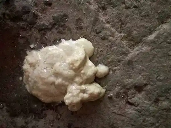 13张重口实图讲清楚宝宝大便问题