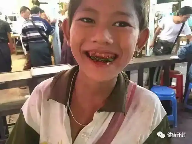 湖南已全面禁止槟榔广告,你还在吃槟榔吗?