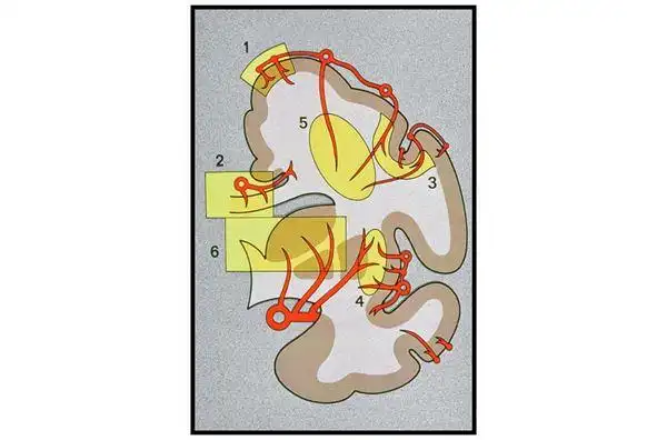 (图为大脑血流供应示意图)