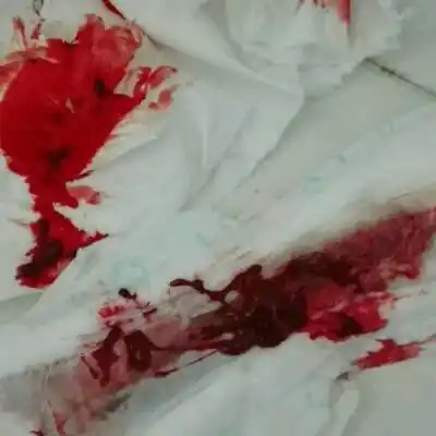 我怀孕四周五天今天生化了现在血好多来好大一团血块,好后悔也不知道