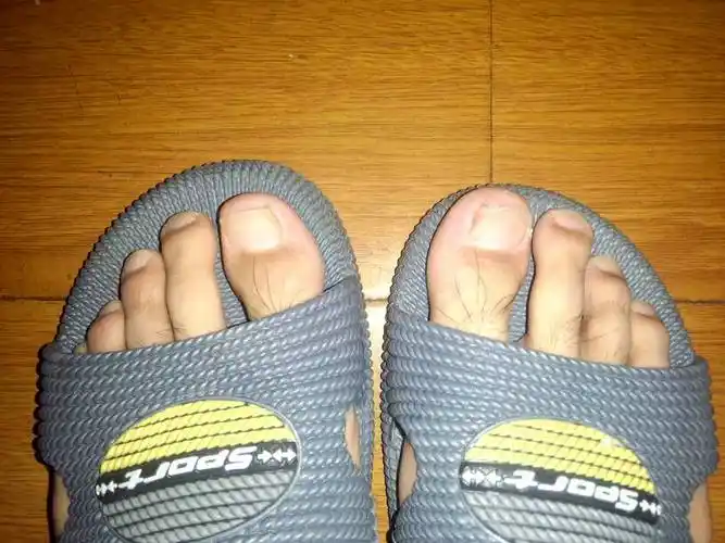 为什么我的大脚趾头是往上翘着长得 穿袜子都被钻破了