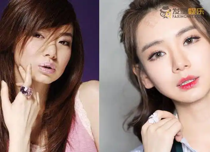 戚薇整容前后照片近期,网友们深扒出其早前的旧照片,今昔照片经过对比