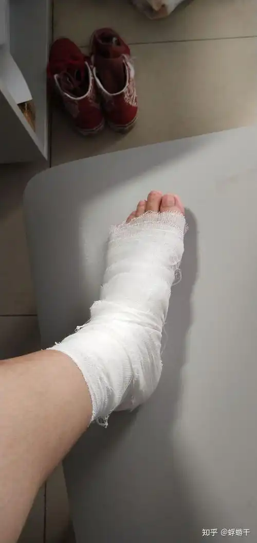 会了ollie,但我脚崴了,啊哈哈哈.