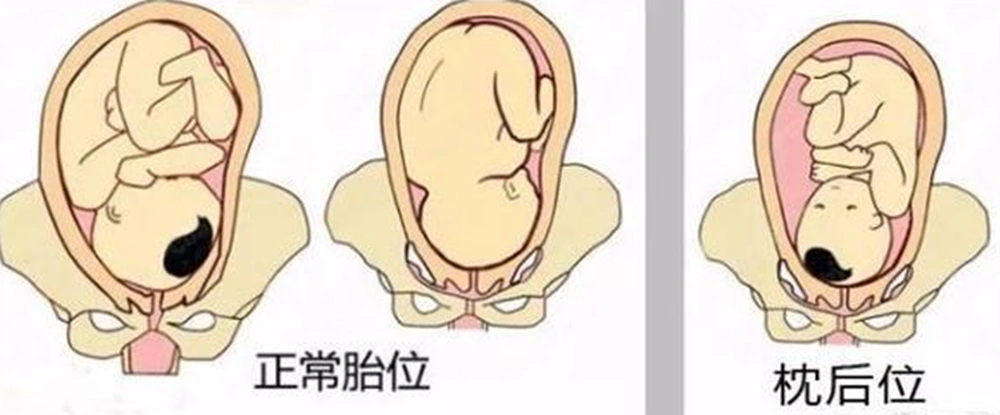 顺产生娃医生这个动作比内检更尴尬让产妇终身难忘