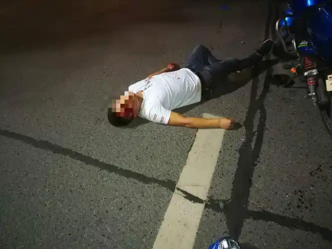 逆向行驶摩托车突现 男子被撞当场重度昏迷
