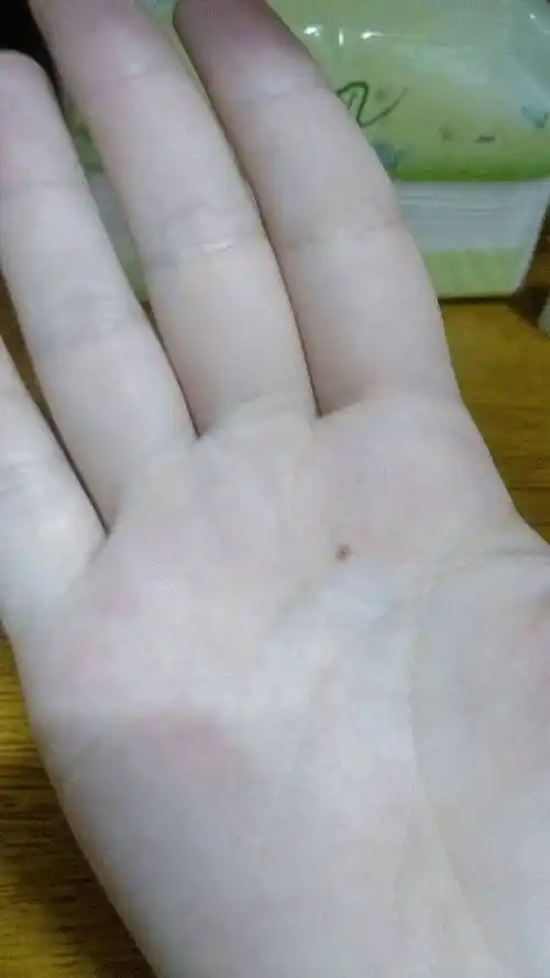 我的手心有颗痣,好么,求大师看一下