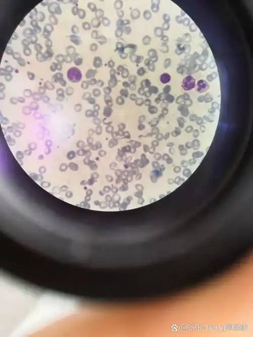 显微镜下的白细胞全家福