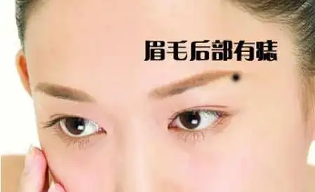 女人得财痣:痣相算命手腕长痣一生福禄丰厚!-风雅颂易学网