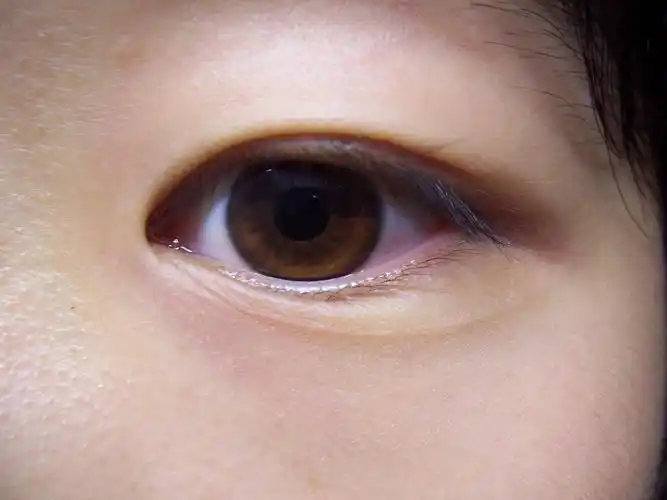 中国人虹膜颜色