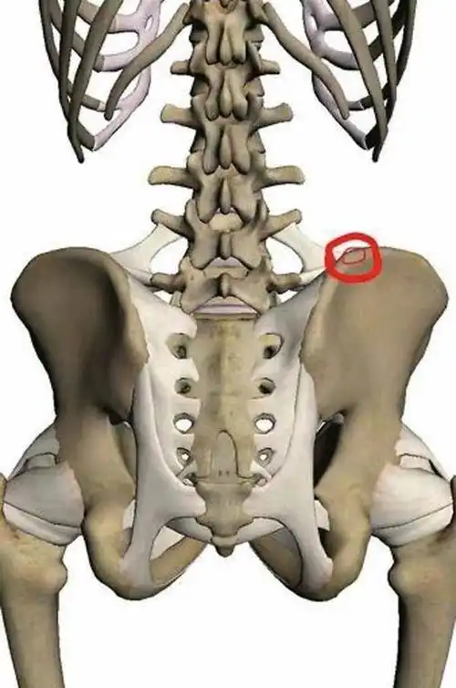 (左侧髂部位置示意图/图片自网络)
