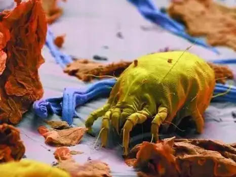 在1000倍显微镜下,可以清晰地看到头螨