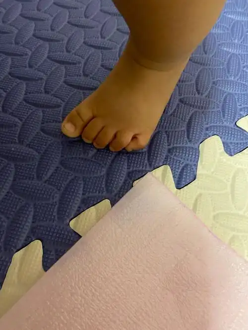 小宝宝脚上的小拇指弯曲