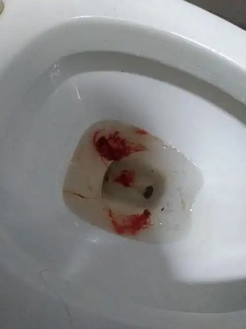 16周,前段时间胸口闷,最近偶尔胸口痛,有时伴有呕吐,最近两次还有吐血