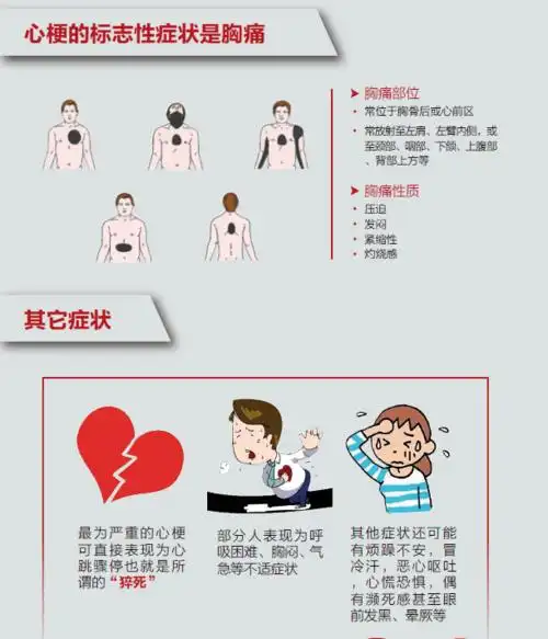图说急性心肌梗死