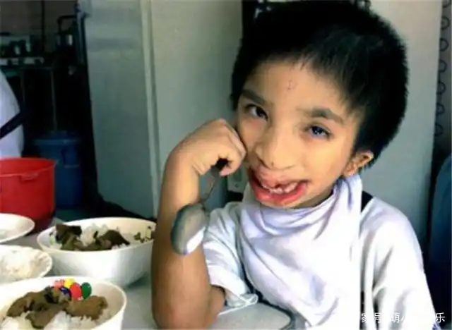 "鸟脸"妈妈不顾劝阻坚持二胎,娃出生后,全家叹气后悔不已