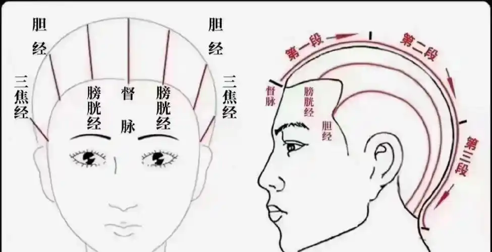 膀胱经不通头两侧疼——胆经不通头部环行头痛—脾经不通经络通百病消