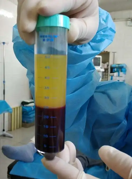 全自动血小板分离仪第一次离心