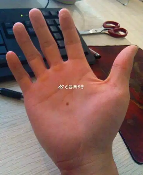"你掌心的痣,我总记得在哪里"从相学角度来说,手掌心有痣的男人,属于