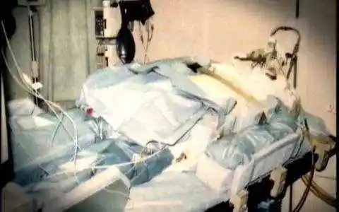 1999年核辐射使他全身dna断裂被强行续命83天目睹自己腐烂