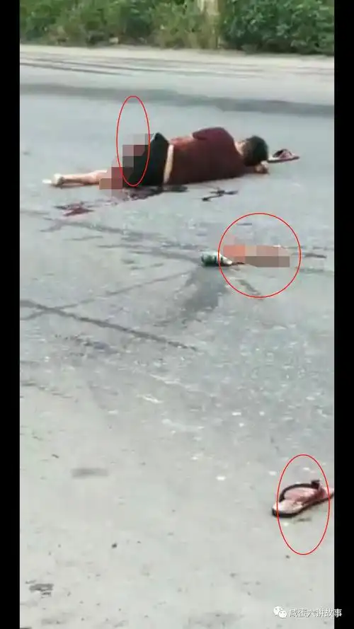 慎入藤县天平车祸摩托车倒地脚断了