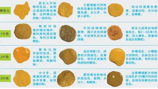 宝宝大便怎样才算正常