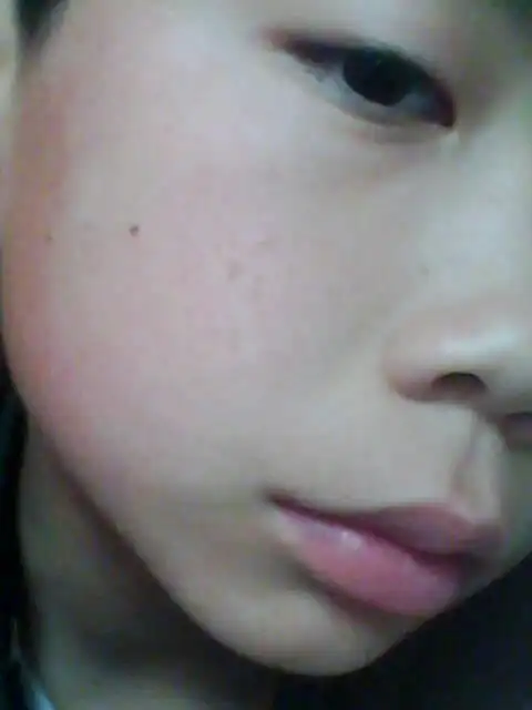 我脸上的是蝇子屎吗?