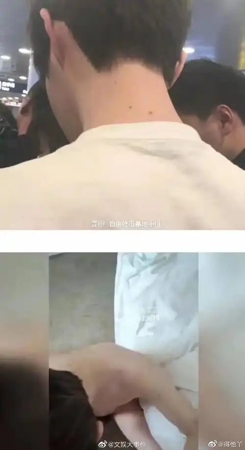 王喆为什么叫口哥,王喆八颗痣事件是怎么回事?