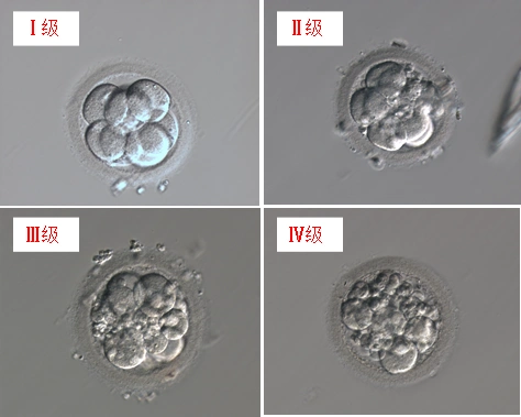 我中心采用的胎评分方法,首先是记录胚胎的细胞(卵裂球)个数,然后再
