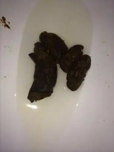 怎么大便这种颜色?