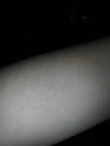 好像斑的,生在皮肤上.手臂上.