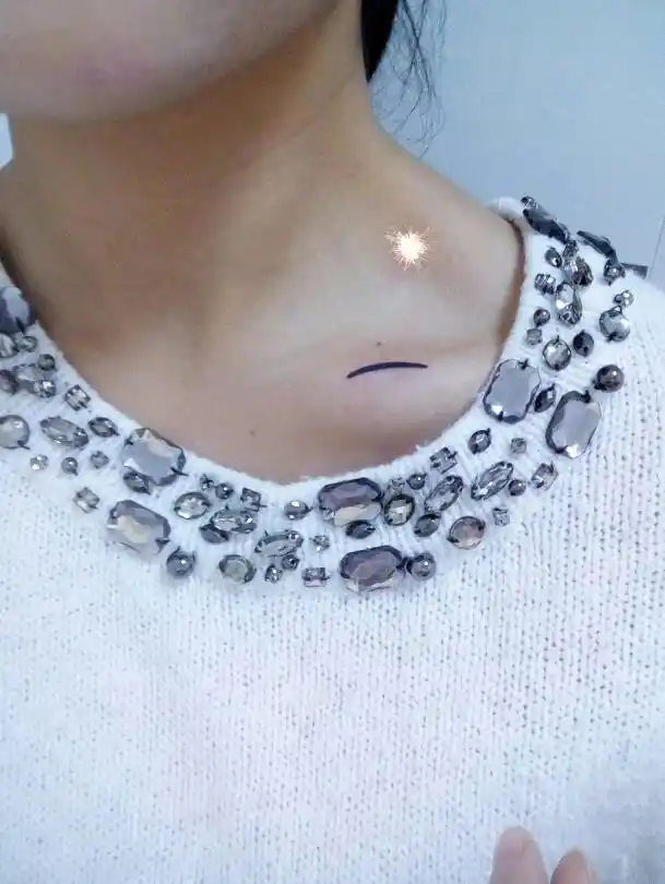 左侧锁骨上面又长出淋巴结淋巴结一直不断增多