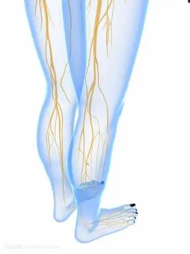 为了瘦腿居然有人切断了小腿的神经