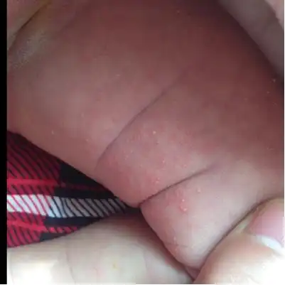 女宝贝大腿内侧,这是什麼啊