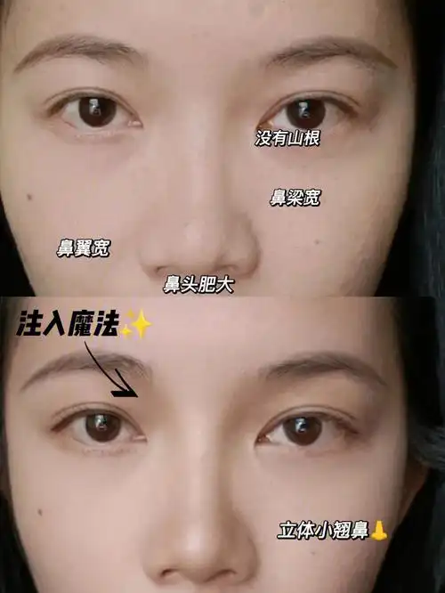 大鼻头女孩自救法75宽鼻翼修容教程