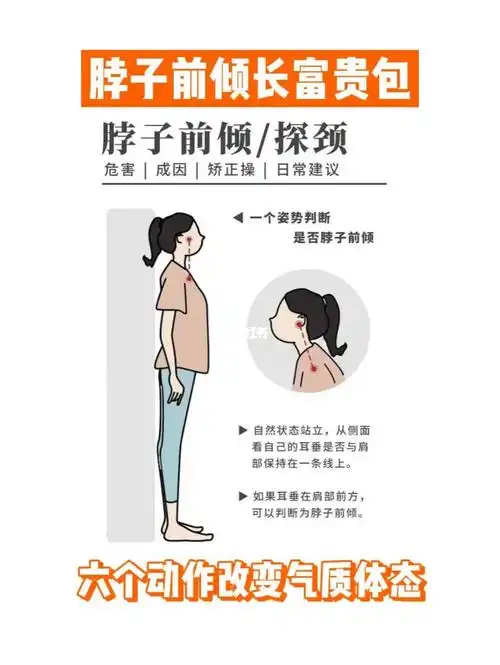 感觉自己脖子前倾怎么办71长富贵包怎么办71741