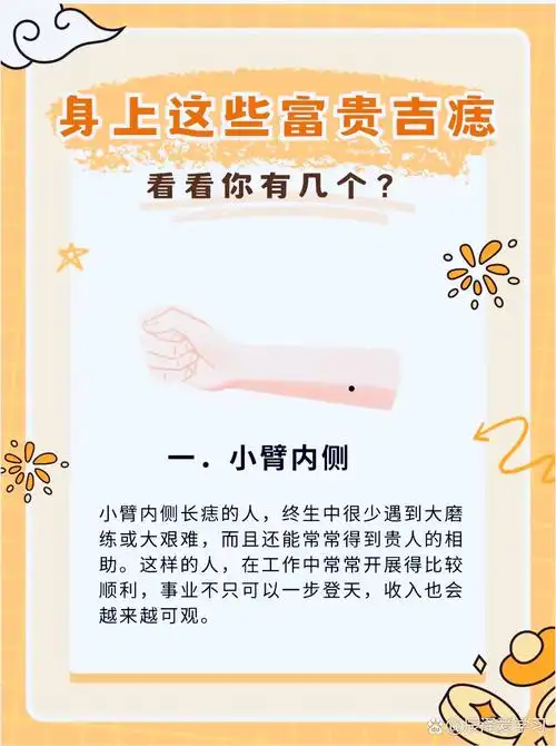 身上这些富贵吉痣看看你有几个